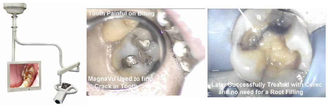 Magnified IntraOral Video - Tangmere Dental Care - Dentists in
